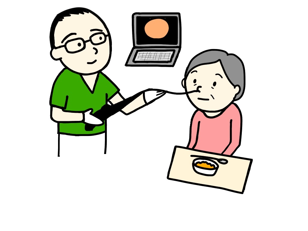 嚥下内視鏡による飲み込む力の評価